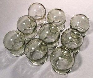 Cupping Glass Medical Fire Chinese Massage Anti Cellulite Leeching Kit 