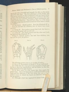 1877 96 27 Surgical Papers Parker Club Foot Medical